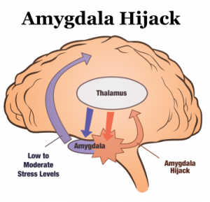 amygdala hijack